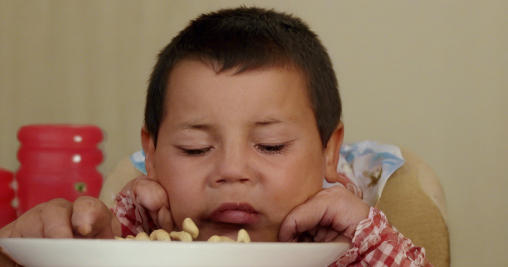Food Allergies: Symptoms, Causes, and Management