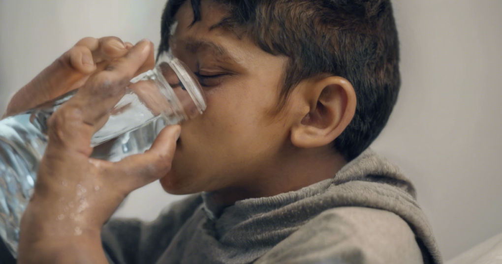 Cholera: Causes, Symptoms, and Prevention